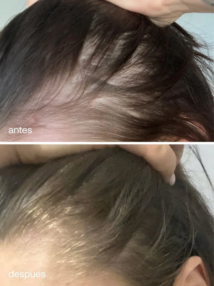 Acondicionador Mini para el Cabello - Image 6