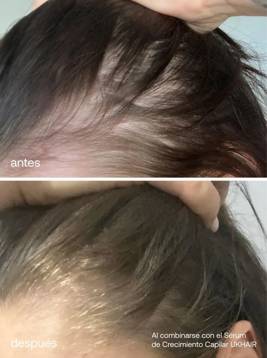 Mini Esenciales para el Cuidado del Cabello - Image 6