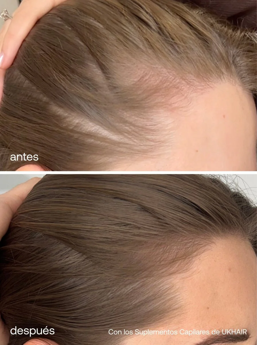 Sérum de Crecimiento del Cabello + Suplementos Capilares Avanzados - Image 6