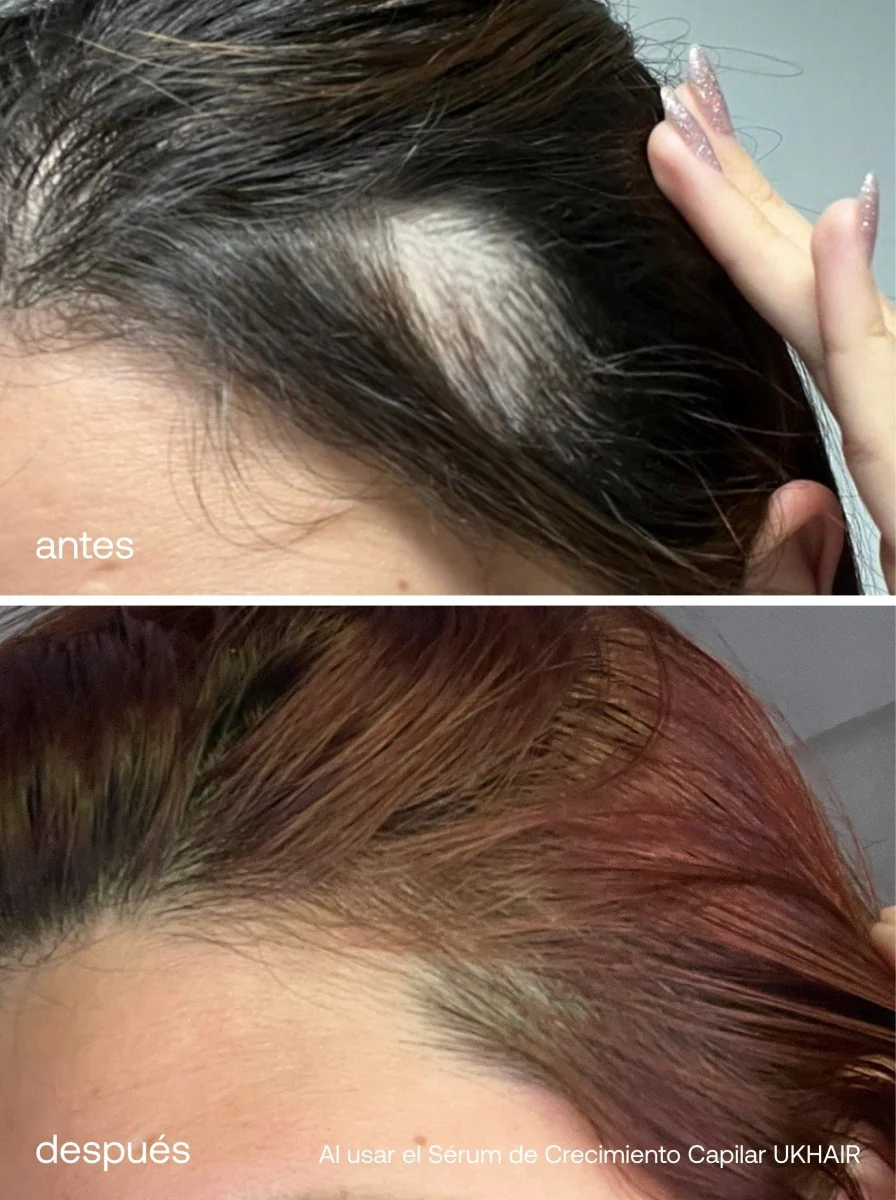 Kit Definitivo para Fortalecer el Cabello - Image 6